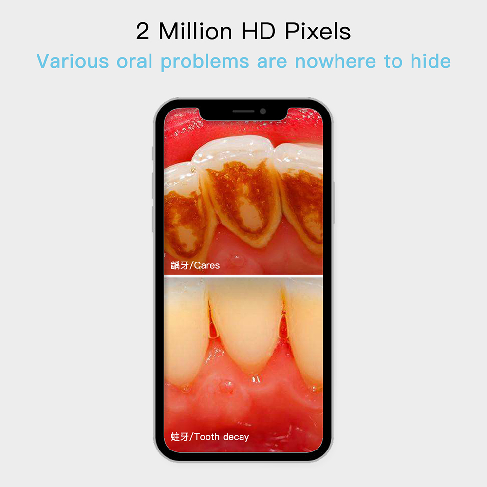 zobu kamera pilna HD mutes zobārstniecības kamera